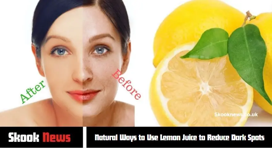 Natural Ways to Use Lemon Juice to Reduce Dark Spots