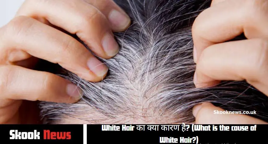 White Hair का क्या कारण है? (What is the cause of White Hair?)